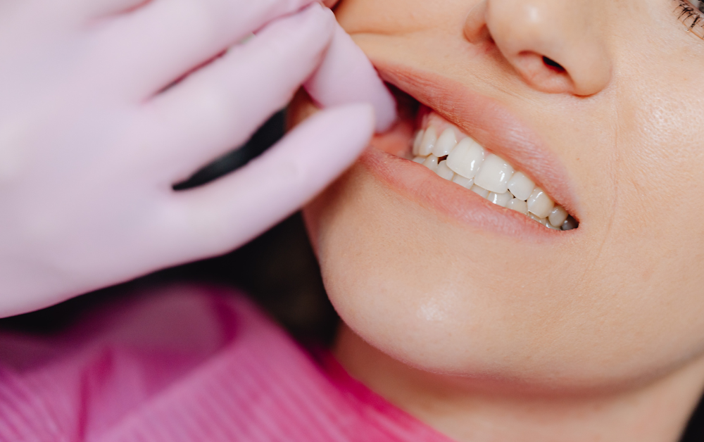 Endodontické ošetrenie – kontrola zuba pred liečbou koreňových kanálikov